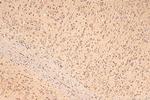 OTOF Antibody in Immunohistochemistry (Paraffin) (IHC (P))