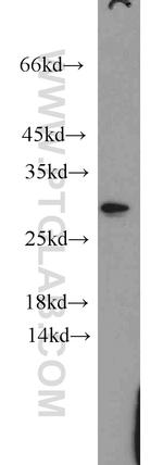 Claudin 22 Antibody in Western Blot (WB)