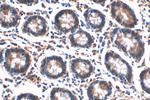 MUC5AC Antibody in Immunohistochemistry (Paraffin) (IHC (P))