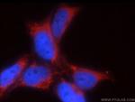 GNRHR2 Antibody in Immunocytochemistry (ICC/IF)