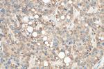 GNRHR2 Antibody in Immunohistochemistry (Paraffin) (IHC (P))