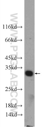 GNRHR2 Antibody in Western Blot (WB)