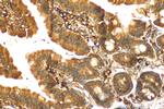 ITPR3 Antibody in Immunohistochemistry (Paraffin) (IHC (P))