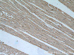 SYNM Antibody in Immunohistochemistry (Paraffin) (IHC (P))
