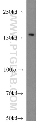 SYNM Antibody in Western Blot (WB)