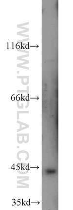 Brachyury-T Antibody in Western Blot (WB)