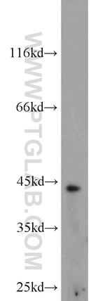 Brachyury-T Antibody in Western Blot (WB)