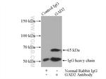 GAD65 Antibody in Immunoprecipitation (IP)