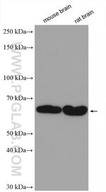 GAD65 Antibody in Western Blot (WB)