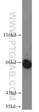 GAD65 Antibody in Western Blot (WB)