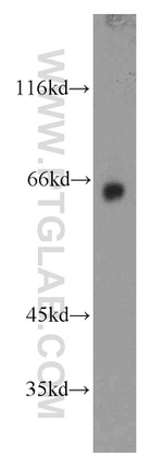 GAD65 Antibody in Western Blot (WB)