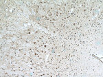 CHAT Antibody in Immunohistochemistry (Paraffin) (IHC (P))
