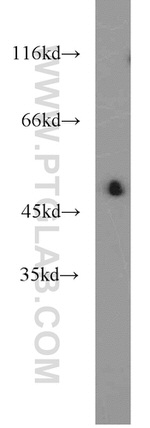 NPT1 Antibody in Western Blot (WB)