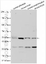 TRAPPC5 Antibody in Western Blot (WB)