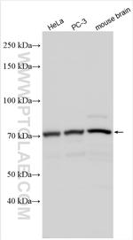 ADAM20 Antibody in Western Blot (WB)