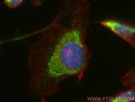 TMEM126A Antibody in Immunocytochemistry (ICC/IF)