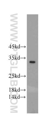 FAM57B Antibody in Western Blot (WB)