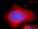 CAPRIN2 Antibody in Immunocytochemistry (ICC/IF)