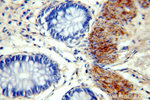 TRMT2B Antibody in Immunohistochemistry (Paraffin) (IHC (P))