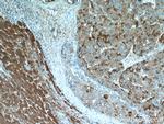 TRMT2B Antibody in Immunohistochemistry (Paraffin) (IHC (P))