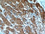 TRMT2B Antibody in Immunohistochemistry (Paraffin) (IHC (P))