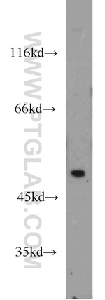 TRMT2B Antibody in Western Blot (WB)