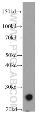 TMEM41A Antibody in Western Blot (WB)