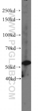 VIPAS39 Antibody in Western Blot (WB)