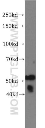 VIPAS39 Antibody in Western Blot (WB)