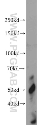 VIPAS39 Antibody in Western Blot (WB)