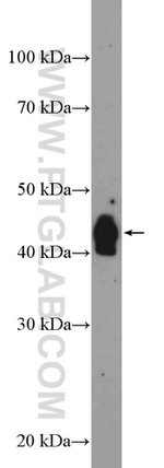 VIPAS39 Antibody in Western Blot (WB)