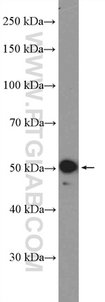 VIPAS39 Antibody in Western Blot (WB)
