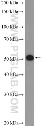VIPAS39 Antibody in Western Blot (WB)