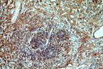 Serum amyloid P component Antibody in Immunohistochemistry (Paraffin) (IHC (P))