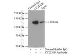 CC2D1B Antibody in Immunoprecipitation (IP)