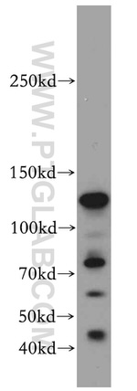 CC2D1B Antibody in Western Blot (WB)