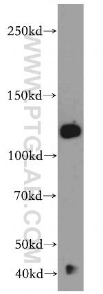 CC2D1B Antibody in Western Blot (WB)