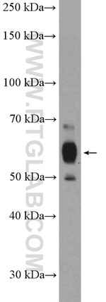 C8orf41 Antibody in Western Blot (WB)