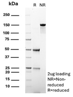 ERG/ETS Transcription Factor (Prostate Cancer Marker) Antibody in SDS-PAGE (SDS-PAGE)