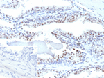 ERG/ETS Transcription Factor (Prostate Cancer Marker) Monoclonal Antibody (ERG1/12589)