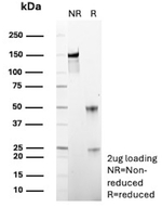 ERG/ETS Transcription Factor (Prostate Cancer Marker) Antibody in SDS-PAGE (SDS-PAGE)