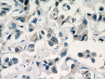 C11orf70 Antibody in Immunohistochemistry (Paraffin) (IHC (P))