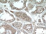C11orf70 Antibody in Immunohistochemistry (Paraffin) (IHC (P))