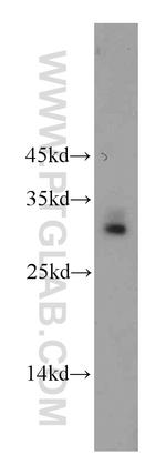 C11orf70 Antibody in Western Blot (WB)