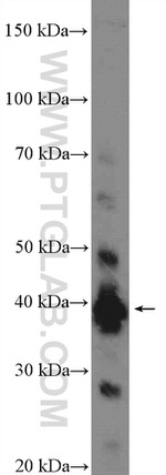 PDCD2L Antibody in Western Blot (WB)