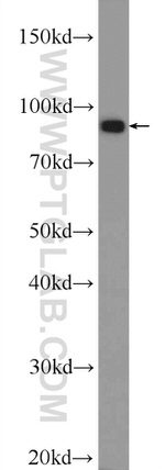 ANO6 Antibody in Western Blot (WB)