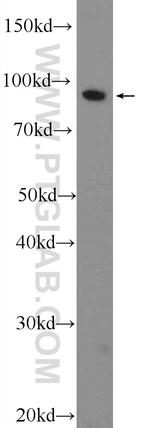 ANO6 Antibody in Western Blot (WB)
