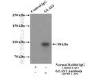 GLAST Antibody in Immunoprecipitation (IP)