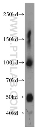 GLAST Antibody in Western Blot (WB)