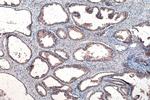 SMO Antibody in Immunohistochemistry (Paraffin) (IHC (P))